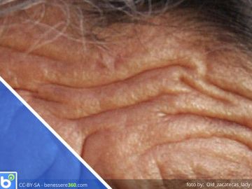 Invecchiamento cutaneo: cause e rimedi (creme e trattamenti per la pelle)