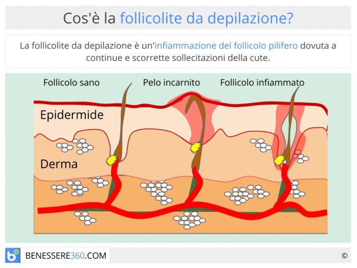 irritazione pelle gambe