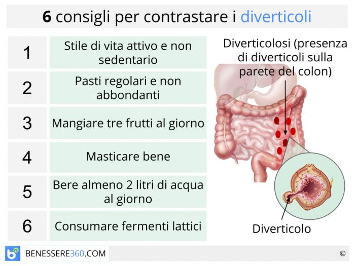 dieta x diverticoli)